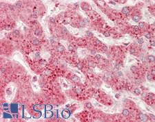 USP2 Antibody - Human Liver: Formalin-Fixed, Paraffin-Embedded (FFPE).  This image was taken for the unconjugated form of this product. Other forms have not been tested.