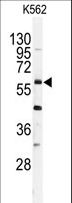 USP2 Antibody - Western blot of anti-USP2 Antibody (C-term L523) in K562 cell line lysates (35 ug/lane). USP2(arrow) was detected using the purified antibody.