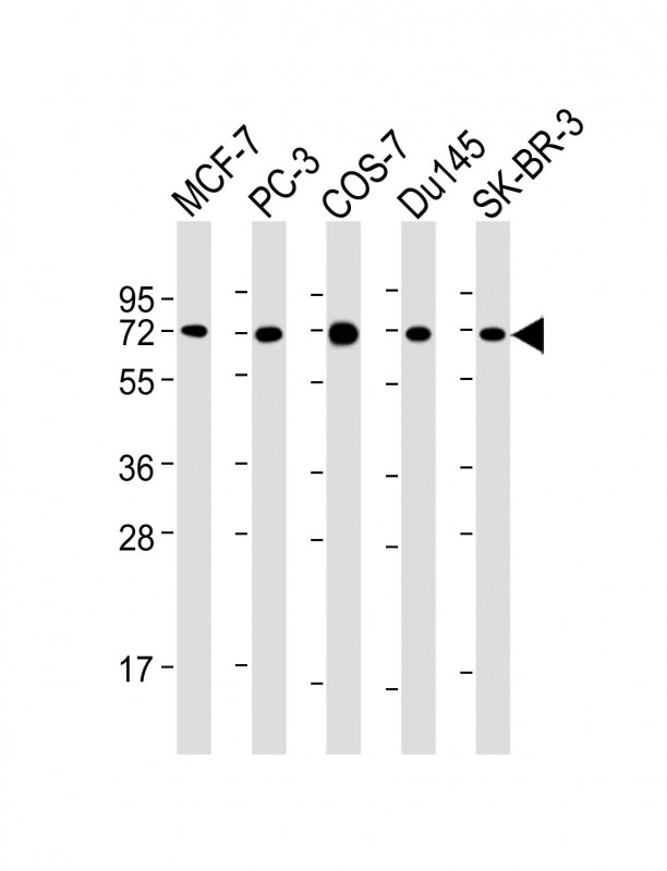USP2 Antibody - All lanes: Anti-USP2 Antibody at 1:2000 dilution Lane 1: MCF-7 whole cell lysate Lane 2: PC-3 whole cell lysate Lane 3: COS-7 whole cell lysate Lane 4: Du145 whole cell lysate Lane 5: SK-BR-3 whole cell lysate Lysates/proteins at 20 µg per lane. Secondary Goat Anti-mouse IgG, (H+L), Peroxidase conjugated at 1/10000 dilution. Predicted band size: 68 kDa Blocking/Dilution buffer: 5% NFDM/TBST.