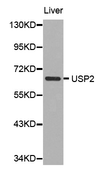 USP2 Antibody - Western blot analysis of extracts of human liver, using USP2 antibody. The secondary antibody used was an HRP Goat Anti-Rabbit IgG (H+L) at 1:10000 dilution. Lysates were loaded 25ug per lane and 3% nonfat dry milk in TBST was used for blocking.