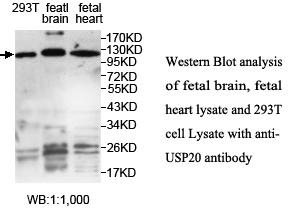 USP20 / VDU2 Antibody