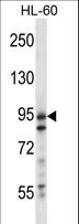 USP20 / VDU2 Antibody - USP20 Antibody western blot of HL-60 cell line lysates (35 ug/lane). The USP20 antibody detected the USP20 protein (arrow).