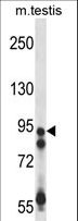 USP20 / VDU2 Antibody - USP20 Antibody western blot of mouse testis tissue lysates (35 ug/lane). The USP20 antibody detected the USP20 protein (arrow).
