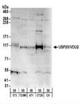 USP20 / VDU2 Antibody - Detection of Mouse USP20/VDU2 by Western Blot. Samples: Whole cell lysate (50 ug) from NIH3T3, TCMK-1, 4T1, CT26.WT, and rat C6 cells. Antibodies: Affinity purified rabbit anti-USP20/VDU2 antibody used for WB at 1 ug/ml. Detection: Chemiluminescence with an exposure time of 3 minutes.