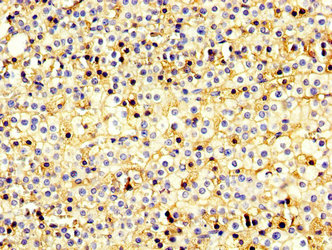 USP20 / VDU2 Antibody - Immunohistochemistry image at a dilution of 1:200 and staining in paraffin-embedded human adrenal gland tissue performed on a Leica BondTM system. After dewaxing and hydration, antigen retrieval was mediated by high pressure in a citrate buffer (pH 6.0) . Section was blocked with 10% normal goat serum 30min at RT. Then primary antibody (1% BSA) was incubated at 4 °C overnight. The primary is detected by a biotinylated secondary antibody and visualized using an HRP conjugated SP system.