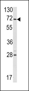USP21 Antibody - Western blot of hUSP21-L241 in NCI-H460 cell line lysates (35 ug/lane). USP21 (arrow) was detected using the purified antibody.