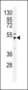 USP21 Antibody - Western blot of anti-USP21 Antibody in T47D cell line lysates (35 ug/lane). USP21 (arrow) was detected using the purified antibody.
