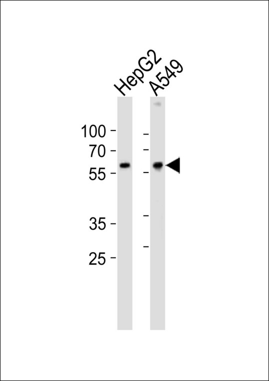 USP22 Antibody - Western blot of lysates from HepG2, A549 cell line (from left to right), using USP22 Antibody. Antibody was diluted at 1:1000 at each lane. A goat anti-rabbit IgG H&L (HRP) at 1:10000 dilution was used as the secondary antibody. Lysates at 20ug per lane.