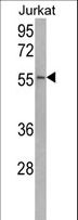 USP22 Antibody - Western blot of USP22 Antibody in Jurkat cell line lysates (35 ug/lane). USP22 (arrow) was detected using the purified antibody.