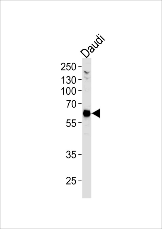 USP22 Antibody - USP22 Antibody western blot of Daudi cell line lysates (35 ug/lane). The USP22 antibody detected the USP22 protein (arrow).