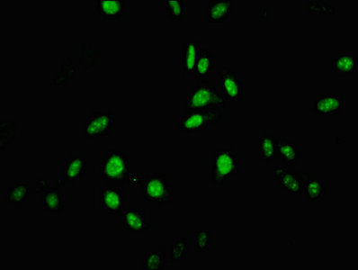 USP22 Antibody - Immunofluorescent analysis of Hela cells at a dilution of 1:100 and Alexa Fluor 488-congugated AffiniPure Goat Anti-Rabbit IgG(H+L)