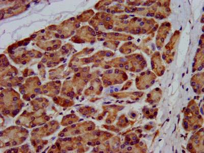 USP24 Antibody - Immunohistochemistry image at a dilution of 1:200 and staining in paraffin-embedded human pancreatic tissue performed on a Leica BondTM system. After dewaxing and hydration, antigen retrieval was mediated by high pressure in a citrate buffer (pH 6.0) . Section was blocked with 10% normal goat serum 30min at RT. Then primary antibody (1% BSA) was incubated at 4 °C overnight. The primary is detected by a biotinylated secondary antibody and visualized using an HRP conjugated SP system.