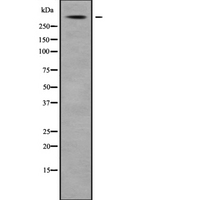 USP24 Antibody - Western blot analysis USP24 using Jurkat whole cells lysates