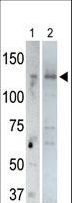 USP25 Antibody - The anti-USP25 C-term antibody is used in Western blot to detect USP25 in rat testis tissue lysate (lane 1) and USP25-transfected HeLa cell lysates (lane 2). Transfection data is kindly provided by Dr. B. Pierrat from the Novartis Institute for Biomedical Research (Basel, Switzerland).