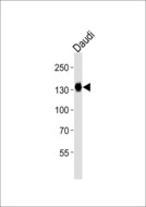 USP25 Antibody - Western blot of lysate from Daudi cell line with USP25 Antibody. Antibody was diluted at 1:1000. A goat anti-mouse IgG H&L (HRP) at 1:5000 dilution was used as the secondary antibody. Lysate at 35 ug.