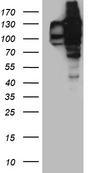 USP25 Antibody - HEK293T cells were transfected with the pCMV6-ENTRY control. (Left lane) or pCMV6-ENTRY USP25. (Right lane) cDNA for 48 hrs and lysed. Equivalent amounts of cell lysates. (5 ug per lane) were separated by SDS-PAGE and immunoblotted with anti-USP25. (1:2000)