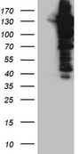 USP25 Antibody - HEK293T cells were transfected with the pCMV6-ENTRY control. (Left lane) or pCMV6-ENTRY USP25. (Right lane) cDNA for 48 hrs and lysed. Equivalent amounts of cell lysates. (5 ug per lane) were separated by SDS-PAGE and immunoblotted with anti-USP25. (1:2000)