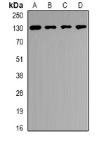 USP25 Antibody - Western blot analysis of USP25 expression in SKOV3 (A); PC12 (B); mouse brain (C); mouse liver (D) whole cell lysates.