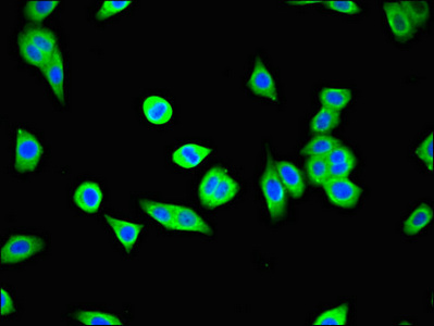 USP25 Antibody - Immunofluorescent analysis of HepG2 cells using USP25 Antibody at dilution of 1:100 and Alexa Fluor 488-congugated AffiniPure Goat Anti-Rabbit IgG(H+L)