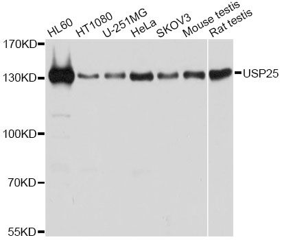 USP25 Antibody - Western blot analysis of extracts of various cell lines, using USP25 antibody at 1:1000 dilution. The secondary antibody used was an HRP Goat Anti-Rabbit IgG (H+L) at 1:10000 dilution. Lysates were loaded 25ug per lane and 3% nonfat dry milk in TBST was used for blocking. An ECL Kit was used for detection and the exposure time was 1s.