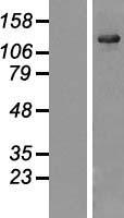 USP25 Protein - Western validation with an anti-DDK antibody * L: Control HEK293 lysate R: Over-expression lysate