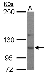 USP26 Antibody - Sample (30 ug of whole cell lysate) A: NT2D1 5% SDS PAGE USP26 antibody diluted at 1:500