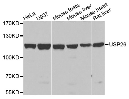 USP26 Antibody - Western blot analysis of extracts of various cells.