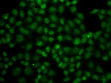 USP26 Antibody - Immunofluorescence analysis of A549 cells.