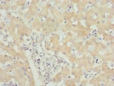 USP26 Antibody - Immunohistochemistry of paraffin-embedded human liver tissue at dilution 1:100