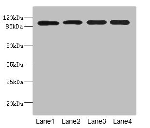 USP26 Antibody - Western blot All Lanes: USP26 antibody at 5.22ug/ml Lane 1: Hela whole cell lysate Lane 2: U937 whole cell lysate Lane 3: Mouse gonadal tissue Lane 4: Mouse liver tissue Secondary Goat polyclonal to Rabbit IgG at 1/10000 dilution Predicted band size: 99 kDa Observed band size: 99 kDa