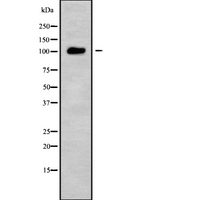USP26 Antibody - Western blot analysis USP26 using HuvEc whole cells lysates