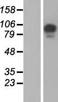 USP26 Protein - Western validation with an anti-DDK antibody * L: Control HEK293 lysate R: Over-expression lysate