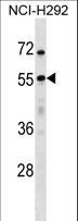 USP27X Antibody - USP27X Antibody western blot of NCI-H292 cell line lysates (35 ug/lane). The USP27X antibody detected the USP27X protein (arrow).
