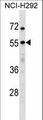 USP27X Antibody - USP27X Antibody western blot of NCI-H292 cell line lysates (35 ug/lane). The USP27X antibody detected the USP27X protein (arrow).