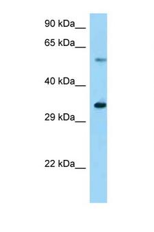 USP27X Antibody - Usp27x antibody Western blot of Mouse Liver lysate. Antibody concentration 1 ug/ml.  This image was taken for the unconjugated form of this product. Other forms have not been tested.