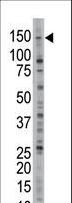 USP28 Antibody - The anti-USP28 antibody is used in Western blot to detect USP28 in Jurkat cell lysate.