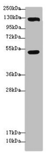 USP28 Antibody - Western blot All Lanes: USP28 antibody at 3.08 ug/ml+ Hela whole cell lysate Secondary Goat polyclonal to rabbit IgG at 1/10000 dilution Predicted band size: 123,120,67 kDa Observed band size: 122,50 kDa