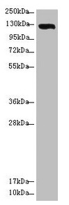 USP28 Antibody - Western blot All lanes: USP28 antibody at 3.08µg/ml + Hela whole cell lysate Secondary Goat polyclonal to rabbit IgG at 1/10000 dilution Predicted band size: 123, 120, 67 kDa Observed band size: 123 kDa