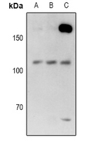 USP28 Antibody - Western blot analysis of USP28 expression in HEK293T (A), A549 (B), mouse heart (C) whole cell lysates.