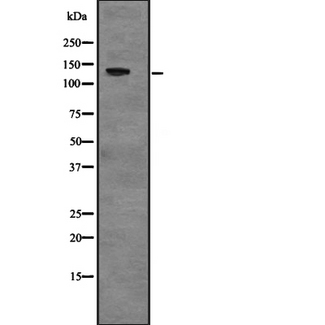 USP28 Antibody - Western blot analysis of USP28 expression in NIH3T3 whole cells lysate. The lane on the left is treated with the antigen-specific peptide.