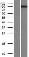 USP28 Protein - Western validation with an anti-DDK antibody * L: Control HEK293 lysate R: Over-expression lysate