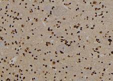 USP29 Antibody - 1:100 staining rat brain tissue by IHC-P. The sample was formaldehyde fixed and a heat mediated antigen retrieval step in citrate buffer was performed. The sample was then blocked and incubated with the antibody for 1.5 hours at 22°C. An HRP conjugated goat anti-rabbit antibody was used as the secondary.