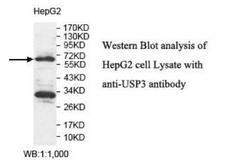 USP3 / UBP Antibody - Western blot of USP3 / UBP antibody