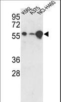USP3 / UBP Antibody - Western blot of hUSP3-Y505 in K562, A375, NCI-H460 cell line lysates (35 ug/lane). USP3 (arrow) was detected using the purified antibody.