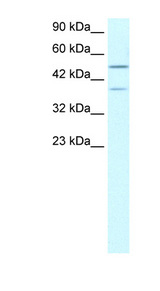 USP3 / UBP Antibody - USP3 antibody Western blot of Jurkat lysate. This image was taken for the unconjugated form of this product. Other forms have not been tested.