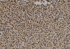 USP3 / UBP Antibody - 1:100 staining mouse kidney tissue by IHC-P. The sample was formaldehyde fixed and a heat mediated antigen retrieval step in citrate buffer was performed. The sample was then blocked and incubated with the antibody for 1.5 hours at 22°C. An HRP conjugated goat anti-rabbit antibody was used as the secondary.
