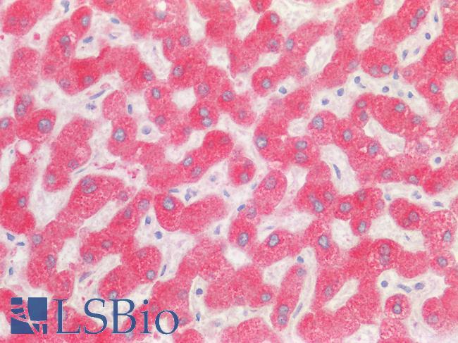 USP30 Antibody - Human Liver, Hepatic Cells: Paraffin-Embedded (FFPE)