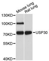 USP30 Antibody - Western blot analysis of extracts of various cell lines, using USP30 antibody at 1:3000 dilution. The secondary antibody used was an HRP Goat Anti-Rabbit IgG (H+L) at 1:10000 dilution. Lysates were loaded 25ug per lane and 3% nonfat dry milk in TBST was used for blocking. An ECL Kit was used for detection and the exposure time was 30s.