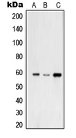 USP30 Antibody - Western blot analysis of USP30 expression in A549 (A); HeLa (B); THP1 (C) whole cell lysates.