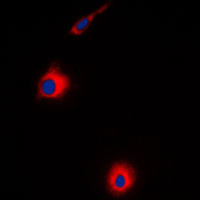 USP30 Antibody - Immunofluorescent analysis of USP30 staining in HeLa cells. Formalin-fixed cells were permeabilized with 0.1% Triton X-100 in TBS for 5-10 minutes and blocked with 3% BSA-PBS for 30 minutes at room temperature. Cells were probed with the primary antibody in 3% BSA-PBS and incubated overnight at 4 C in a humidified chamber. Cells were washed with PBST and incubated with a DyLight 594-conjugated secondary antibody (red) in PBS at room temperature in the dark. DAPI was used to stain the cell nuclei (blue).